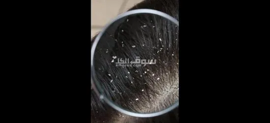 هيربال اسكراب - 6